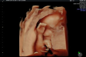 241afebb-ea7a-4b32-9983-017408ce61e2 241afebb-ea7a-4b32-9983-017408ce61e2