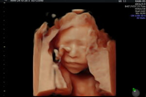 846aa84a-185d-43e9-a25e-0ef9ae6c38ca 846aa84a-185d-43e9-a25e-0ef9ae6c38ca