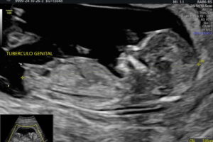 IMG-20241027-WA0016 IMG-20241027-WA0016