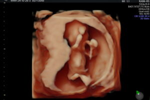 IMG-20241027-WA0017 IMG-20241027-WA0017