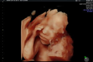 b341a839-ce6a-479b-bb9c-c8bf35b96493 b341a839-ce6a-479b-bb9c-c8bf35b96493